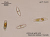 UTEX LB FD123 Navicula radiosa f. tenella | UTEX Culture Collection of Algae