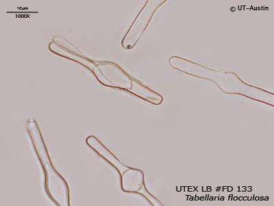 <strong>UTEX LB FD133</strong> <br><i>Tabellaria flocculosa</i>