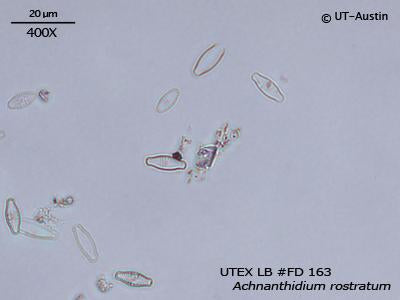 <strong>UTEX LB FD163</strong> <br><i>Achnanthidium rostratum</i>