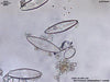 UTEX LB FD166 Anomoeoneis sphaerophora f. costata | UTEX Culture Collection of Algae