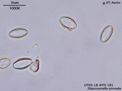 <strong>UTEX LB FD181</strong> <br><i>Staurosirella pinnata</i>
