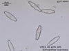 UTEX LB FD185 Achnanthes coarctata | UTEX Culture Collection of Algae