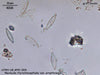 UTEX LB FD205 Navicula rhynchocephala var. amphiceros | UTEX Culture Collection of Algae