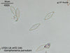 UTEX LB FD240 Gomphonema parvulum | UTEX Culture Collection of Algae