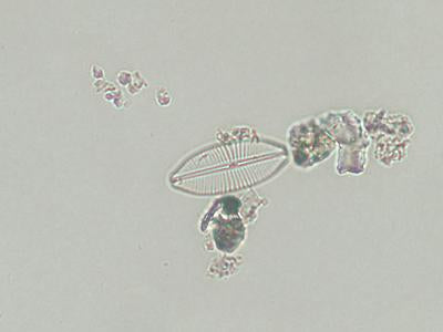 <strong>UTEX LB FD39</strong> <br><i>Craticula cuspidata</i>