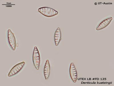 <strong>UTEX LB FD135</strong> <br><i>Denticula kuetzingii</i>