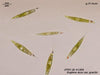 UTEX LB 1304 Euglena acus var. gracilis | UTEX Culture Collection of Algae