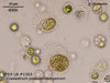 UTEX LB 1353 Coelastrum pseudomicroporum | UTEX Culture Collection of Algae