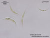 UTEX LB 1379 Ankistrodesmus arcuatus | UTEX Culture Collection of Algae