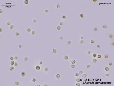 <strong>UTEX LB 2341</strong> <br><i>Chlorella minutissima</i>