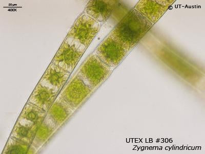 <strong>UTEX LB 306</strong> <br><i>Zygnema cylindricum</i>