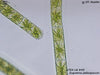 UTEX LB 45 Zygnema peliosporum | UTEX Culture Collection of Algae