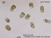UTEX LB 539 Trachelomonas hispida var. coronata | UTEX Culture Collection of Algae