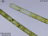 UTEX LB 916 Spirogyra sp. | UTEX Culture Collection of Algae