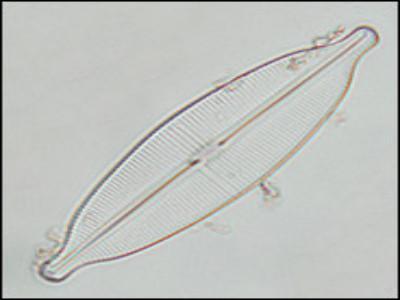 <b>Teaching Kit</b> <br>Diatoms & Symmetry | UTEX Culture Collection of Algae